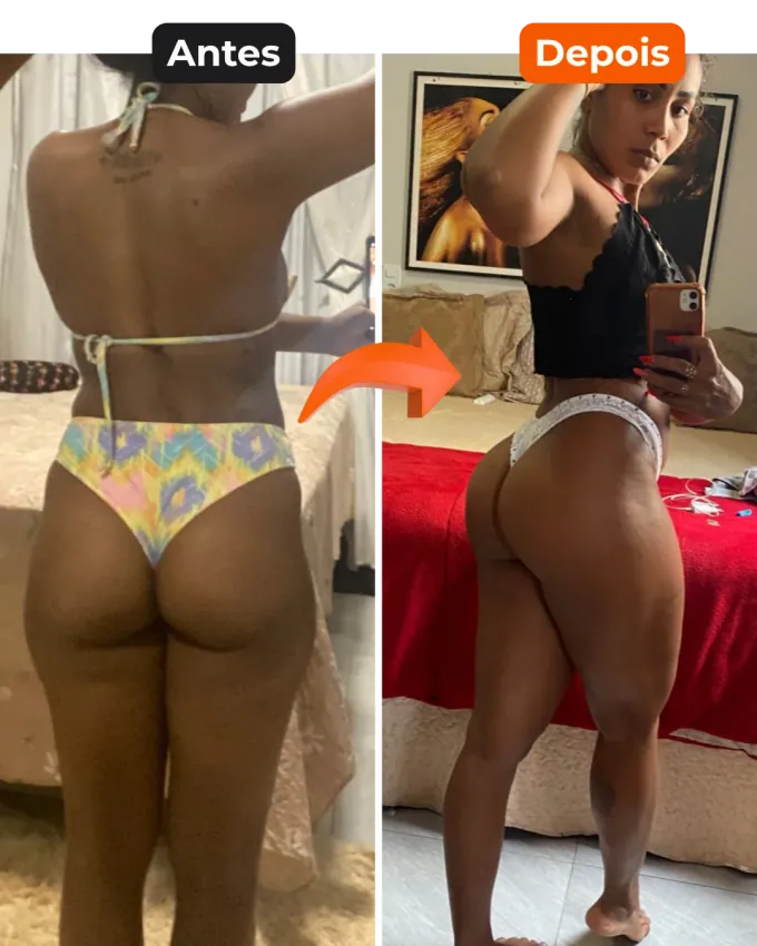 Antes e depois — aluna 1