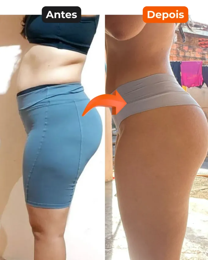 Antes e depois — aluna 2