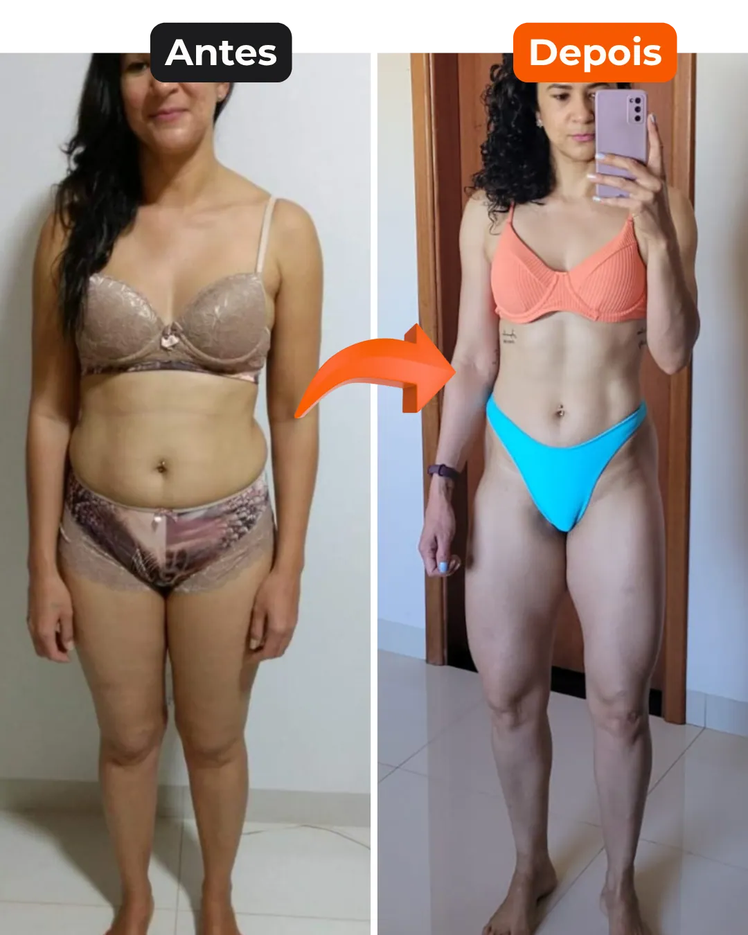 Antes e depois de aluna do Protocolo Perna e Bumbum